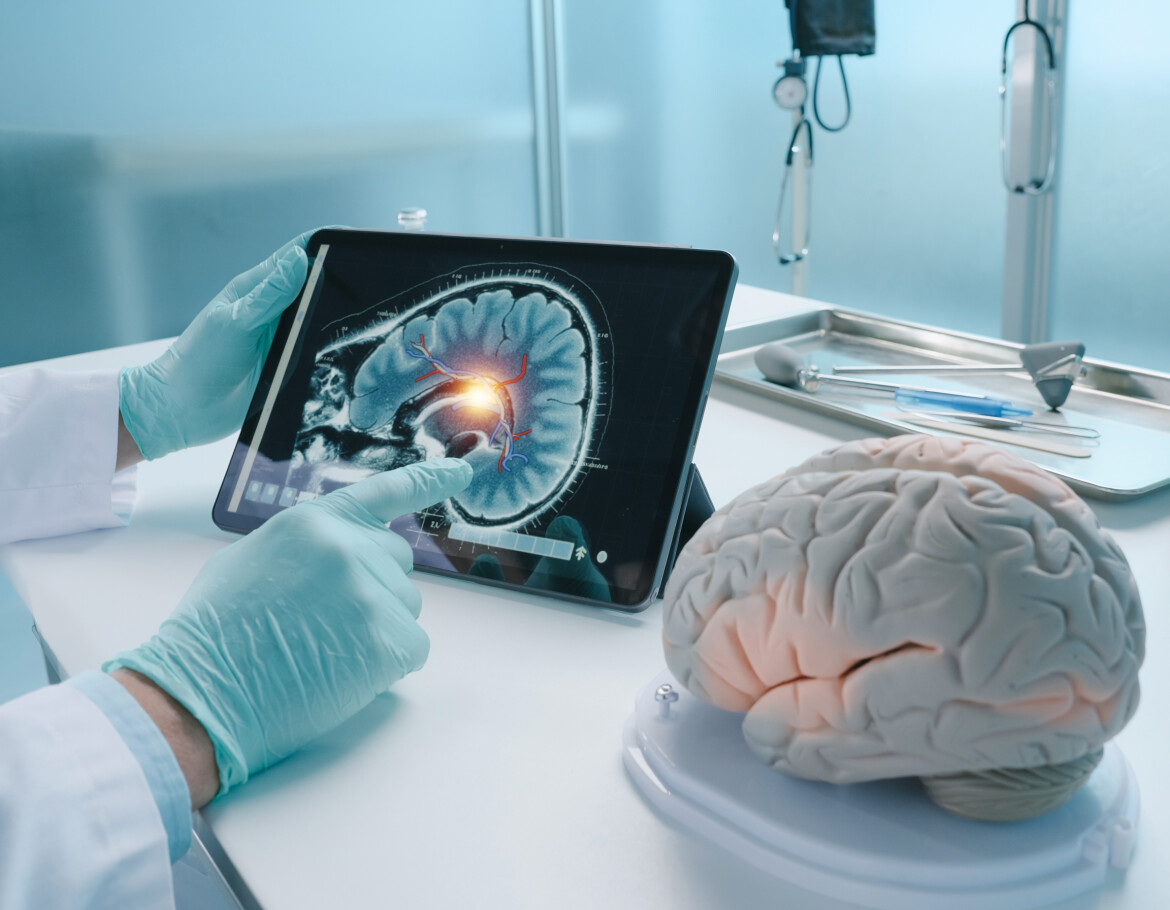 Кому грозит инсульт?